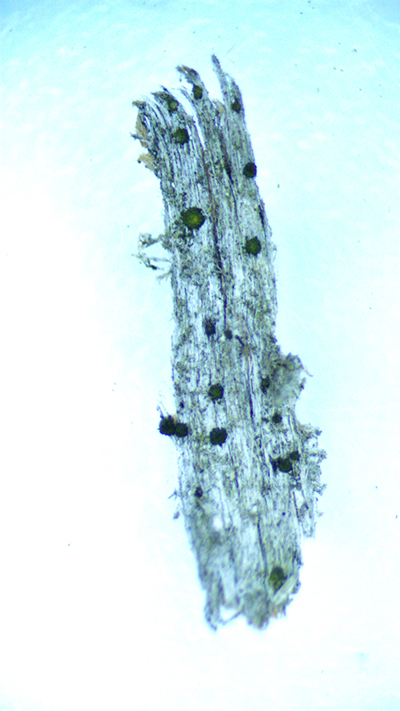 Tiny button lichen detail